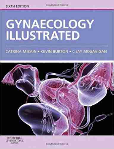 Gynaecology illustrated