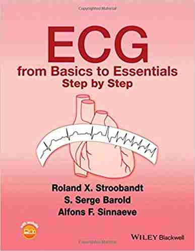 ECG from basics to essentials step by step