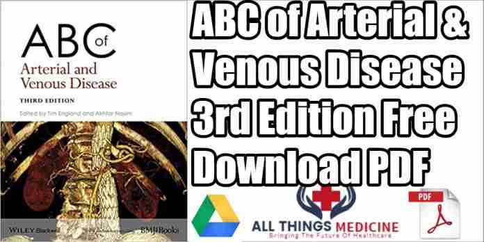 abc-of-arterial-and-venous-disease-pdf