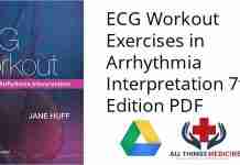 ECG Workout Exercises in Arrhythmia Interpretation 7th Edition PDF