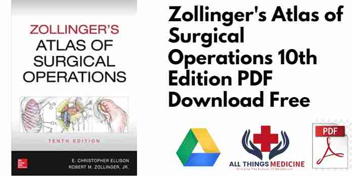 Zollinger's Atlas of Surgical Operations 10th Edition PDF