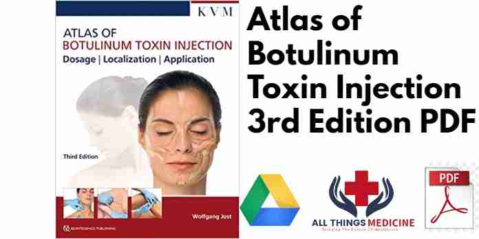 Atlas of Botulinum Toxin Injection 3rd Edition PDF