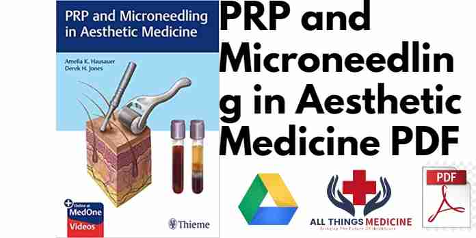 PRP and Microneedling in Aesthetic Medicine PDF