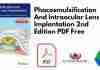 Phacoemulsification And Intraocular Lens Implantation 2nd Edition PDF
