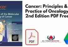 Cancer: Principles & Practice of Oncology 2nd Edition PDF